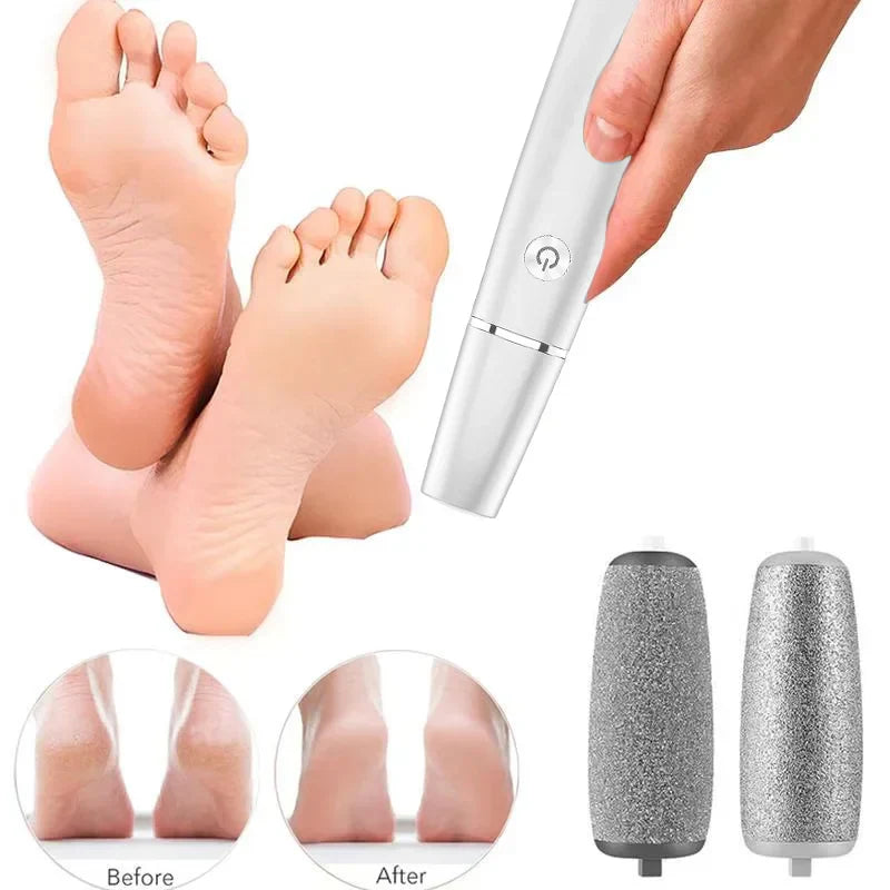 SoftStep Eeltverwijderaar